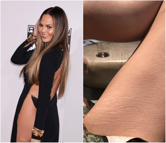 Chrissy Teigen révèle ses vergetures aux cuisses le 18 janvier 2017