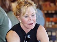 Melanie Griffith : Sans artifices, elle dévoile son second cancer de la peau