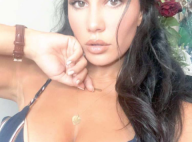Milla Jasmine : Nouvelle chirurgie très critiquée après une vidéo choc