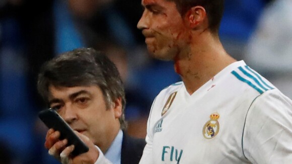 Cristiano Ronaldo : Frappé au visage et en sang sur le terrain...