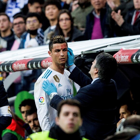 Cristiano Ronaldo a reçu un coup de pied au visage lors du match opposant le Real Madrid au Deportivo, au stade Santiago Bernabeu à Madrid, le 21 janvier 2018