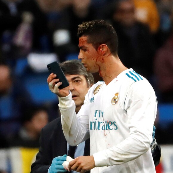 Cristiano Ronaldo a reçu un coup de pied au visage lors du match opposant le Real Madrid au Deportivo, au stade Santiago Bernabeu à Madrid, le 21 janvier 2018
