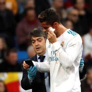 Cristiano Ronaldo a reçu un coup de pied au visage lors du match opposant le Real Madrid au Deportivo, au stade Santiago Bernabeu à Madrid, le 21 janvier 2018