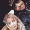 Jessica Thivenin et Thibault Kuro se sont fait refaire le nez, le 19 janvier 2018.