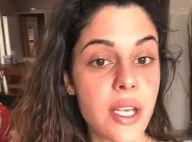 Coralie Porrovecchio brûlée après des UV : Elle partage son calvaire