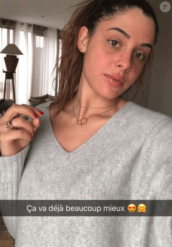 Coralie Porrovecchio brûlée lors d'une séance d'U.V, Snapchat, février 2018