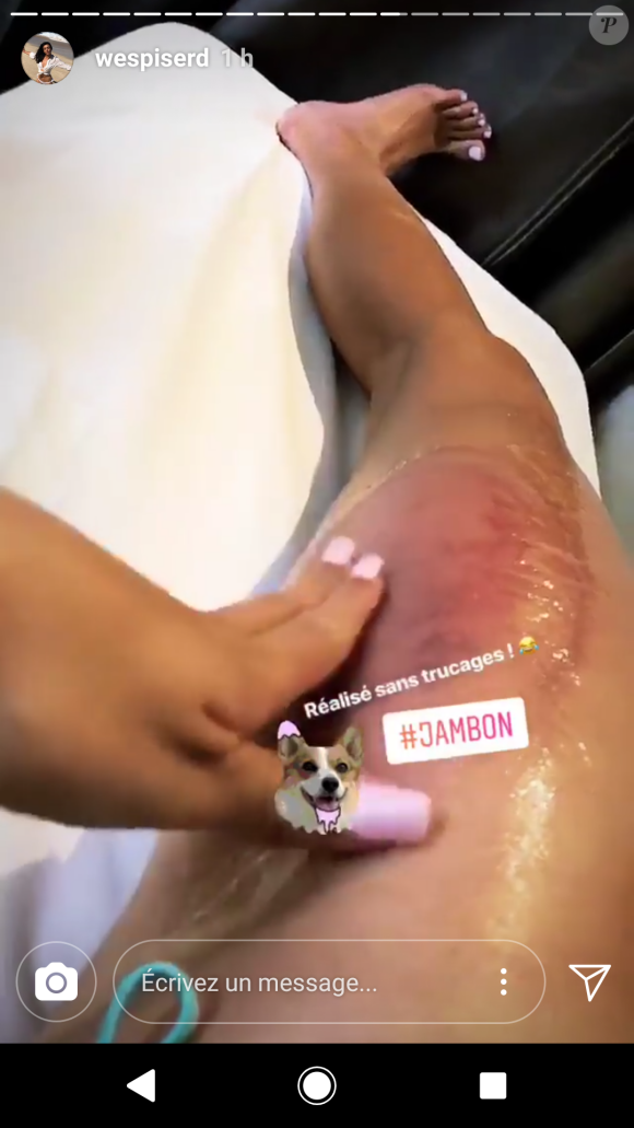 Delphine Wespiser dans un centre d'amincissement - Instagram, 16 mai 2018