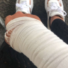 Ayem Nour dévoile sa blessure sur Snapchat, lundi 29 mai 2018