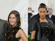 Bella Hadid : La chirurgie esthétique ? "On peut passer mon visage au scanner" !