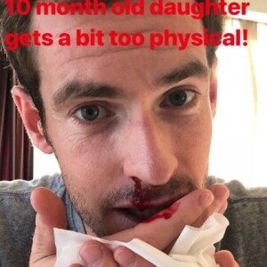 Andy Murray blessé au nez par sa fille de 10 mois, le 28 août 2018.