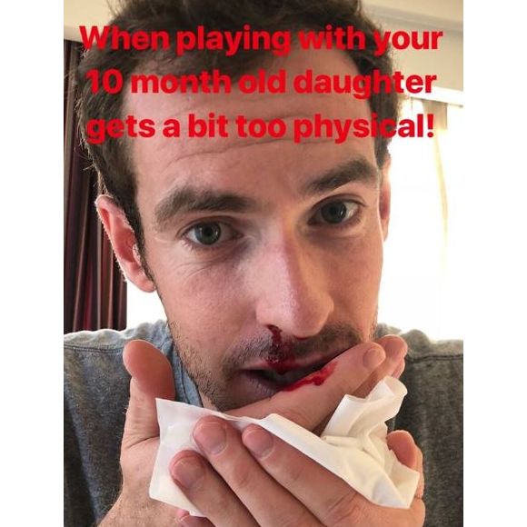 Andy Murray blessé au nez par sa fille de 10 mois, le 28 août 2018.