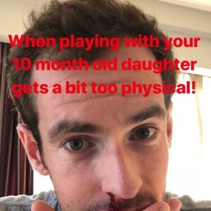 Andy Murray blessé au nez par sa fille de 10 mois, le 28 août 2018.