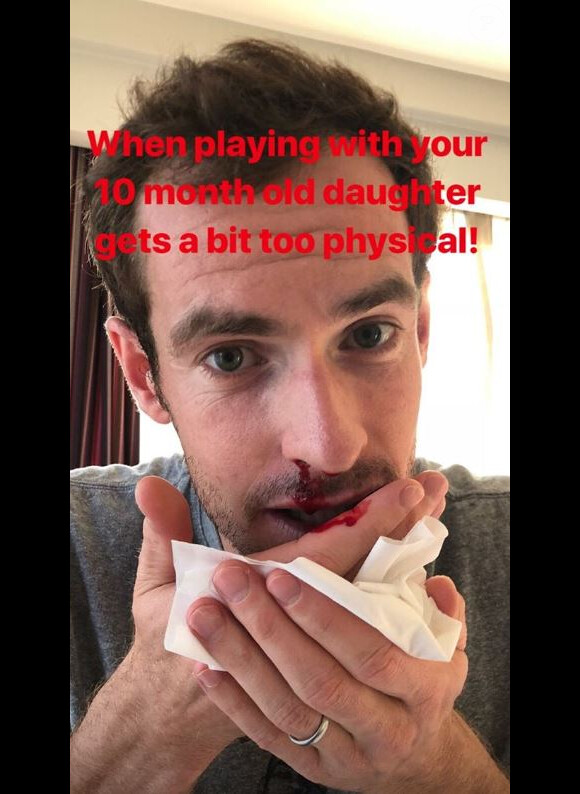 Andy Murray blessé au nez par sa fille de 10 mois, le 28 août 2018.