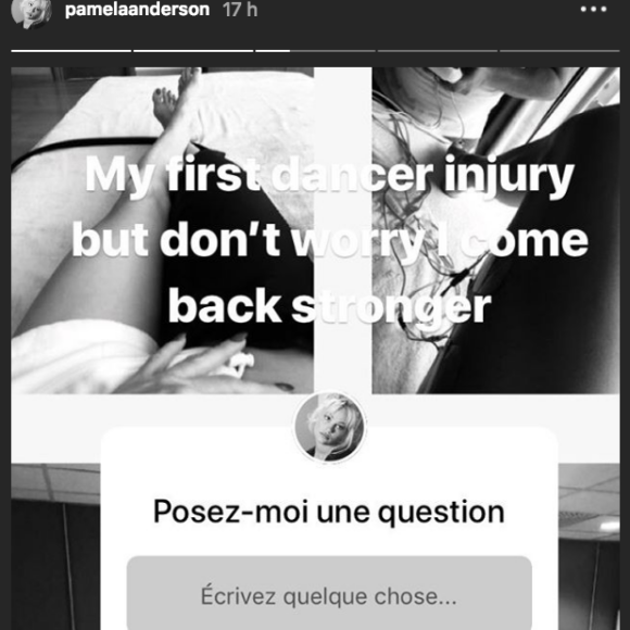 Pamela Anderson se confie sur ses blessures après ses premières répétitions dans "Danse avec les stars 9" sur Instagram le 16 septembre 2018.