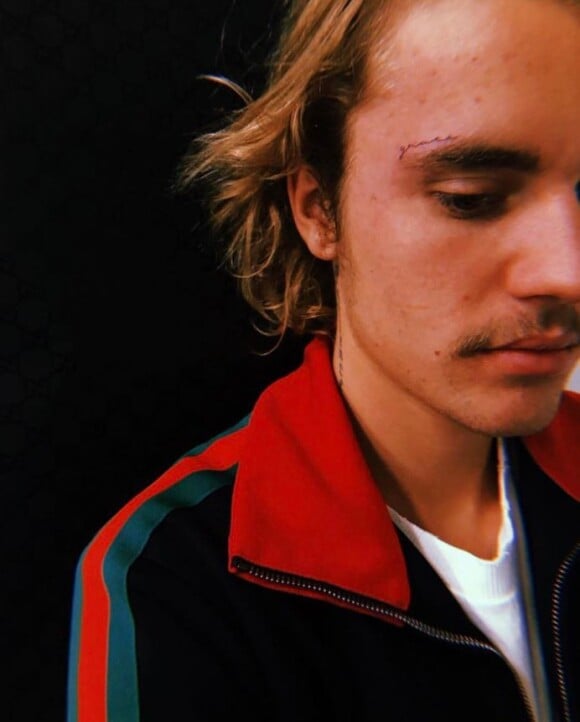 Justin Bieber a un nouveau tatouage sur le visage ! Janvier 2019.