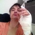 Pete Doherty annonce, ce 30 avril 2019, avoir été hospitalisé en raison d'une blessure qui s'est infectée à la main. Le rockeur s'est piqué sur un hérisson.