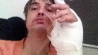 Pete Doherty hospitalisé après une mauvaise rencontre... improbable