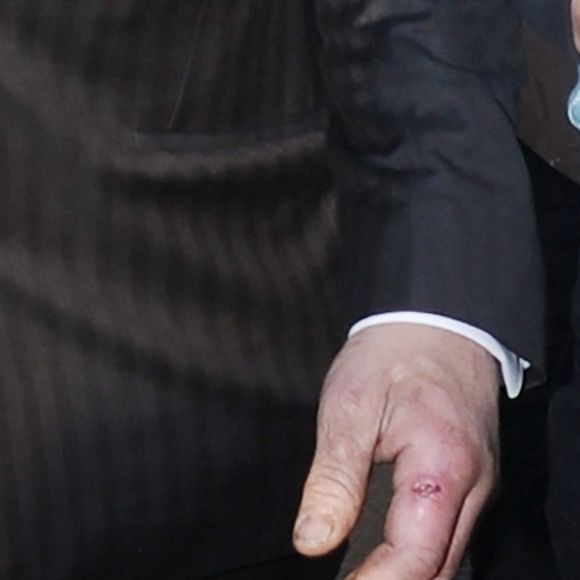 Pete Doherty et sa compagne Katia de Vidas se baladent dans le quartier de Shoreditch à Londres le 29 avril 2019. Pete a une vilaine blessure à l'index gauche.