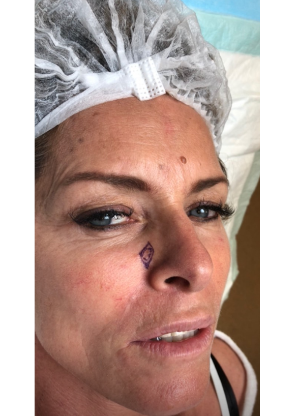 Manuela Lopez des "Mystères de l'amour" révèle avoir été victime d'un cancer de la peau - Instagram, le 8 juillet 2019