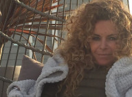 Manuela Lopez atteinte d'un cancer de la peau : des photos choc' dévoilées