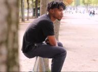Jamsy (Incroyable talent) : Sa brûlure était un "emprisonnement psychologique"