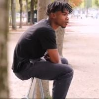 Jamsy (Incroyable talent) : Sa brûlure était un "emprisonnement psychologique"