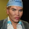 Exclusif - Rodrigo Alves se promène avec un chapeau sur la tête suite à des implants capillaires à Beverly Hills le 20 octobre 2017.