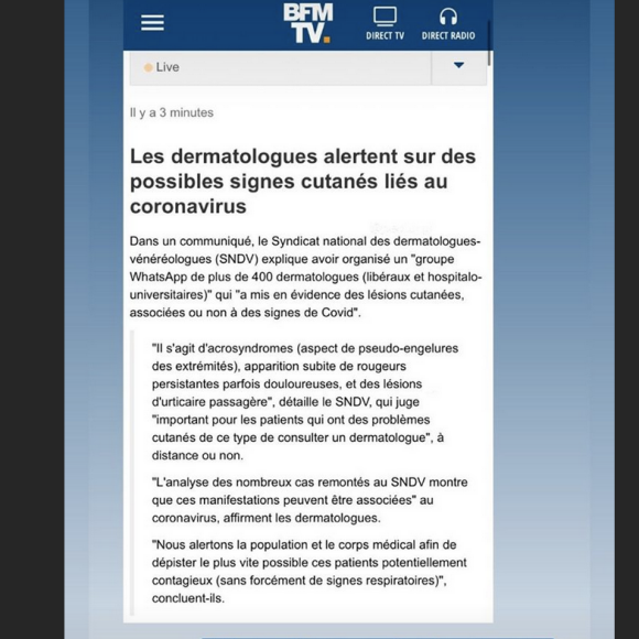 Marine Lorphelin révèle l'apparition de nouveaux symptômes relatifs au coronavirus - Instagram, 8 avril 2020