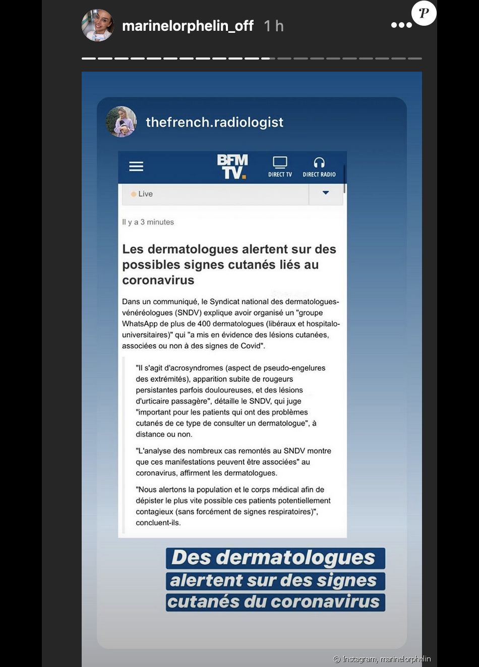 Marine Lorphelin révèle l'apparition de nouveaux symptômes relatifs au coronavirus - Instagram, 8 avril 2020