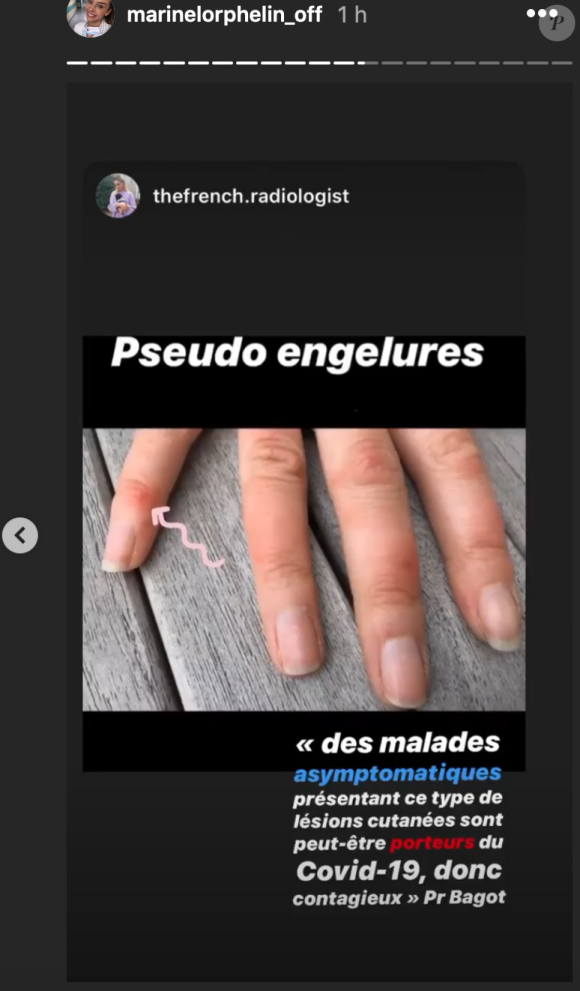 Marine Lorphelin révèle l'apparition de nouveaux symptômes relatifs au coronavirus - Instagram, 8 avril 2020