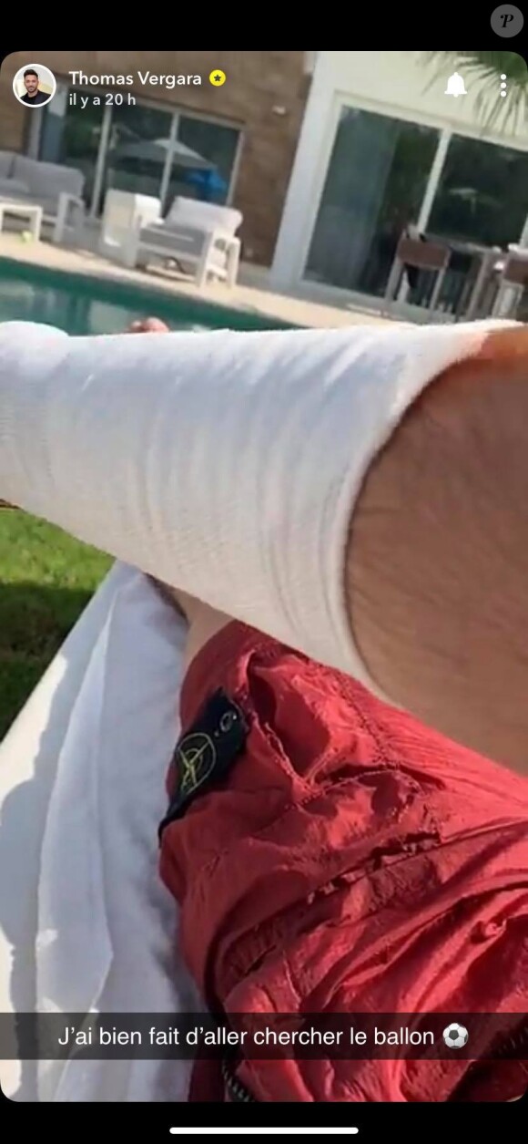 Thomas Vergara se blesse le 18 avril 2020 sur Snapchat.