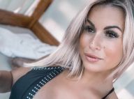 Carla Moreau amincie grâce à la chirurgie esthétique : elle confirme enfin !