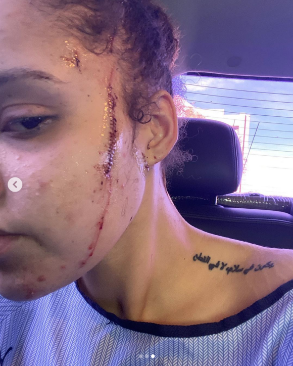 Yasmine Jackson, la nièce de Michael Jackson et fille de sa demi-soeur, Joh'Vonnie Jackson, a été victime d'une agression raciste, à l'arme blanche. Mai 2020.