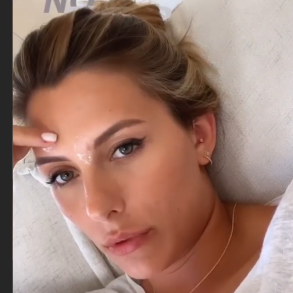 Camille Cerf, naturelle, affiche ses boutons sur Instagram - 22 juin 2020