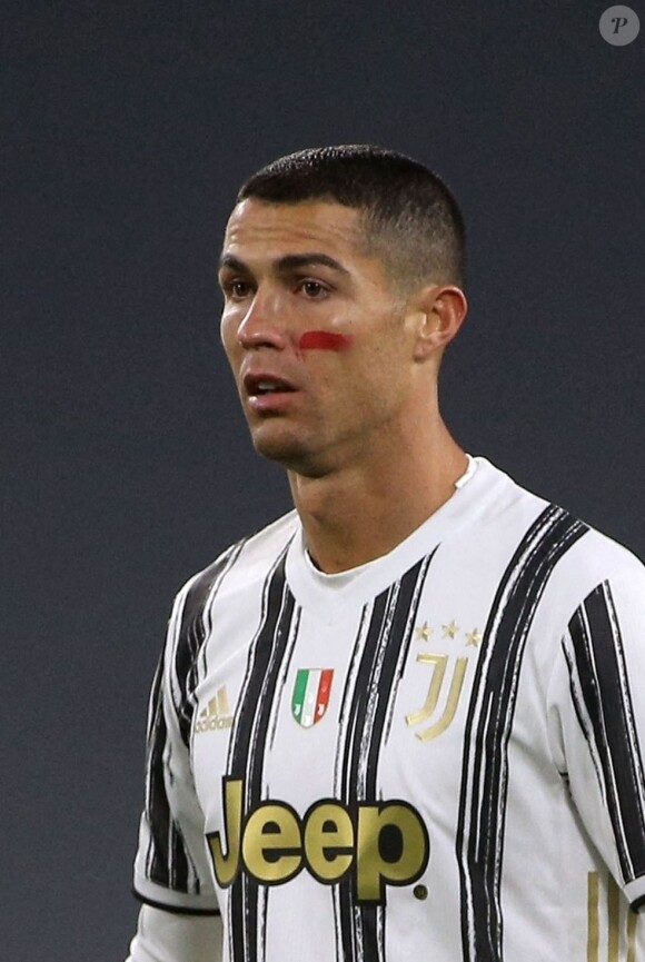 Cristiano Ronaldo et d'autres joueurs de série A portent une trace de maquillage rouge sur le visage pour dénoncer les violences faites aux femmes le 21 novembre 2020.