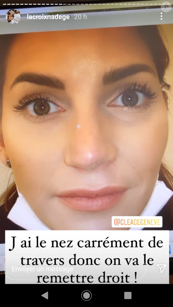 Nadège Lacroix fait une nouvelle rhinoplastie, le 8 décembre 2020