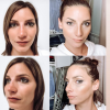 Nadège Lacroix dévoile son nouveau nez sur Instagram, le 16 décembre 2020, une semaine après son opération