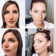 Nadège Lacroix dévoile son nouveau nez sur Instagram, le 16 décembre 2020, une semaine après son opération