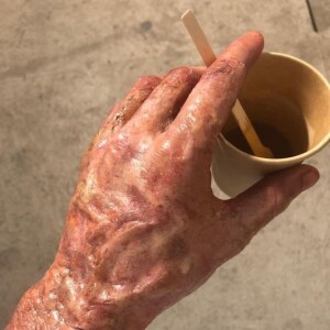 Clément Rémiens dévoile les coulisses de son maquillage pour sa brûlure dans "Ici tout commence", le 1er février 2021