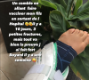 Nathalie Marquay dévoile une photo de sa jambe sous attelle après un accident - Instagram