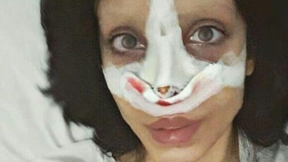 Angelina Jolie : Son sosie zombie méconnaissable avant les opérations