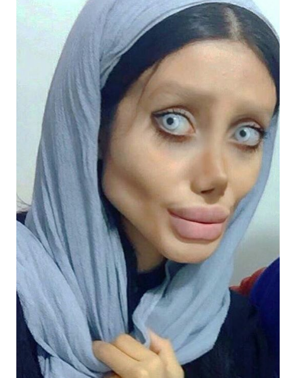 Sahar Tabar, une jeune fan iranienne, fait tout pour ressembler à Angelina Jolie. Selon la presse, elle aurait subi jusqu'à 50 opérations de chirurgie esthétique. Novembre 2017.