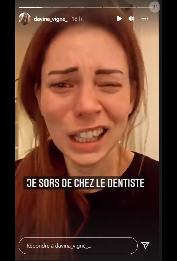 Davina Vigné défigurée après un rendez-vous chez le dentiste, le 16 décembre 2021