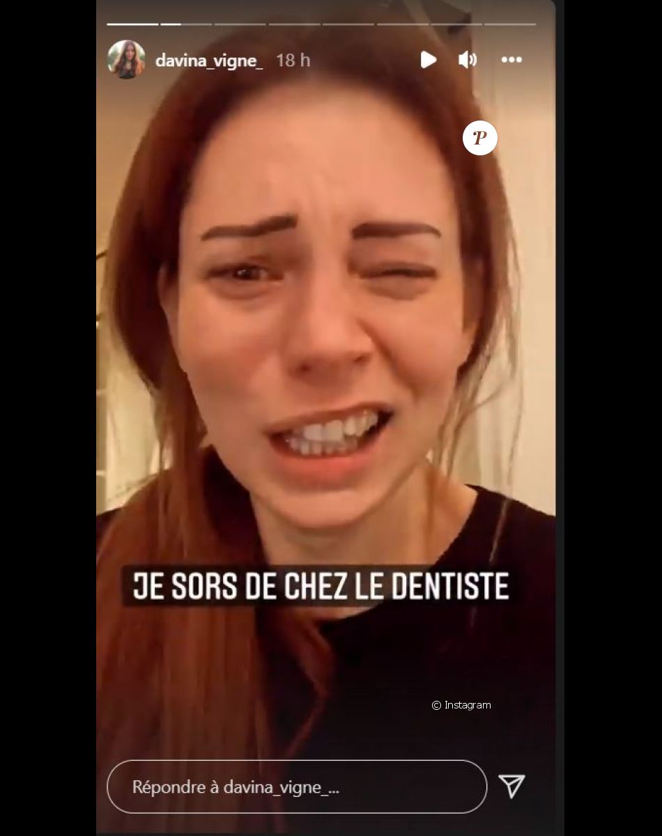 Davina Vigné défigurée après un rendez-vous chez le dentiste, le 16 décembre 2021