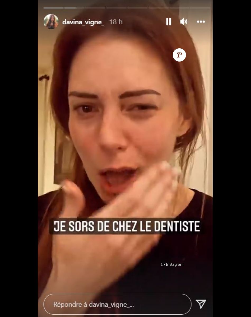 Davina Vigné défigurée après un rendez-vous chez le dentiste, le 16 décembre 2021