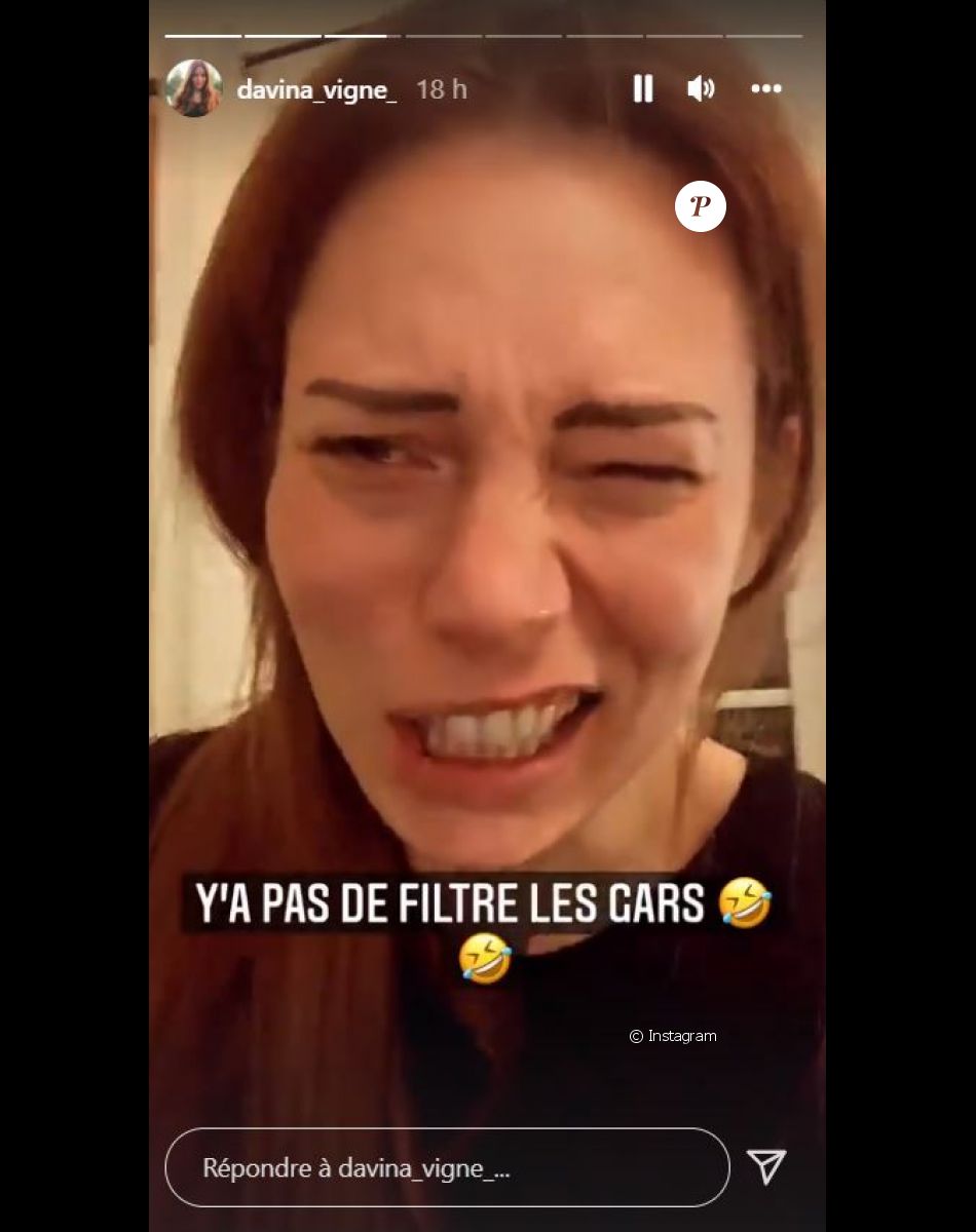 Davina Vigné défigurée après un rendez-vous chez le dentiste, le 16 décembre 2021