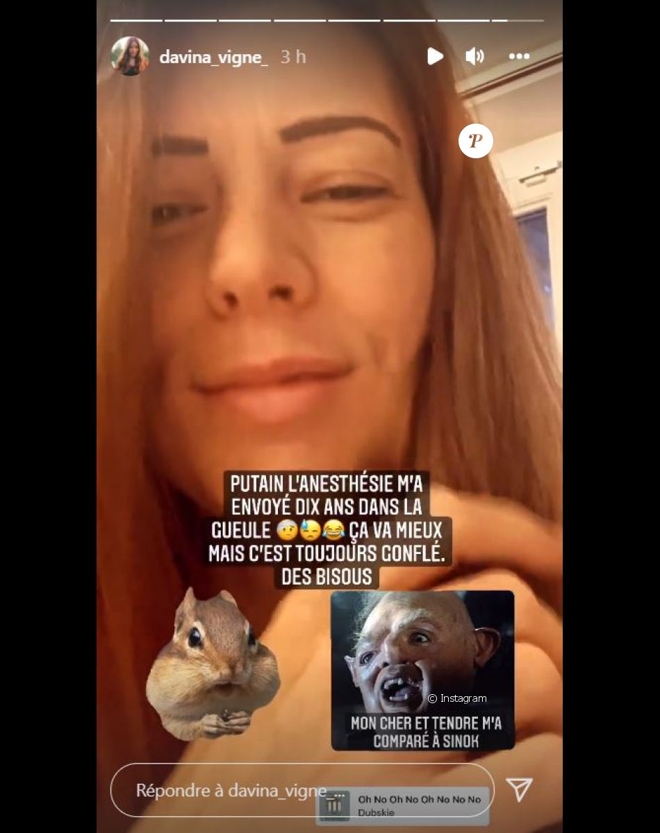 Davina Vigné défigurée après un rendez-vous chez le dentiste, le 16 décembre 2021