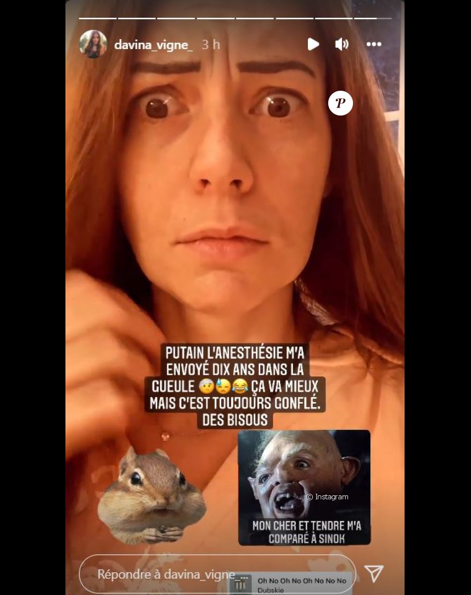 Davina Vigné défigurée après un rendez-vous chez le dentiste, le 16 décembre 2021