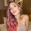 Luna Skye (Les Marseillais) marquée physiquement par ses opérations : photo choc de ses "gros trous"