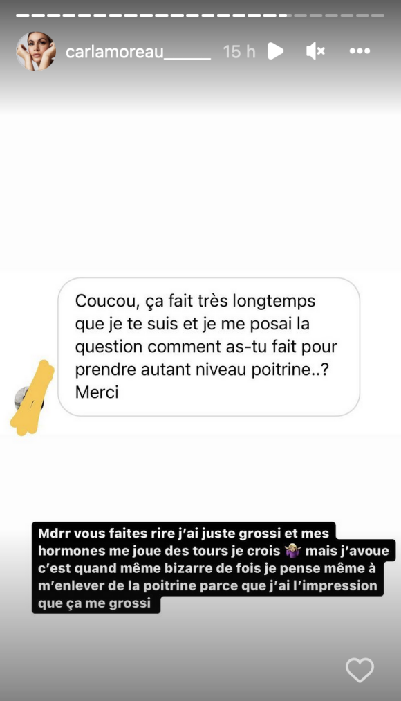 Carla Moreau s'explique sur sa poitrine qui fait parler - Instagram